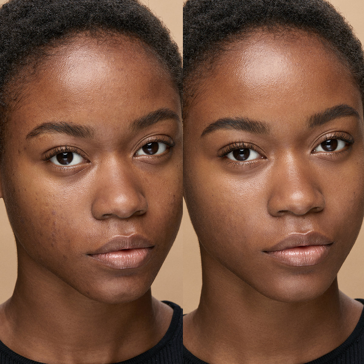Skin Tone Concealer